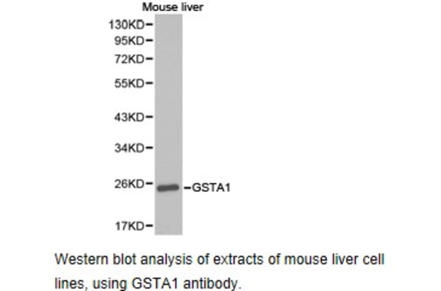 Anti-GSTA1 Antibody from Bioworld Technology (BS6848) - Antibodies.com
