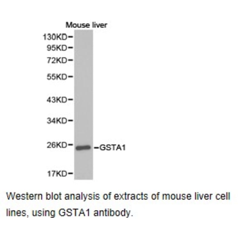 Anti-GSTA1 Antibody from Bioworld Technology (BS6848) - Antibodies.com