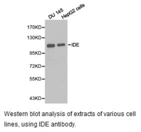 Anti-IDE Antibody from Bioworld Technology (BS6849) - Antibodies.com