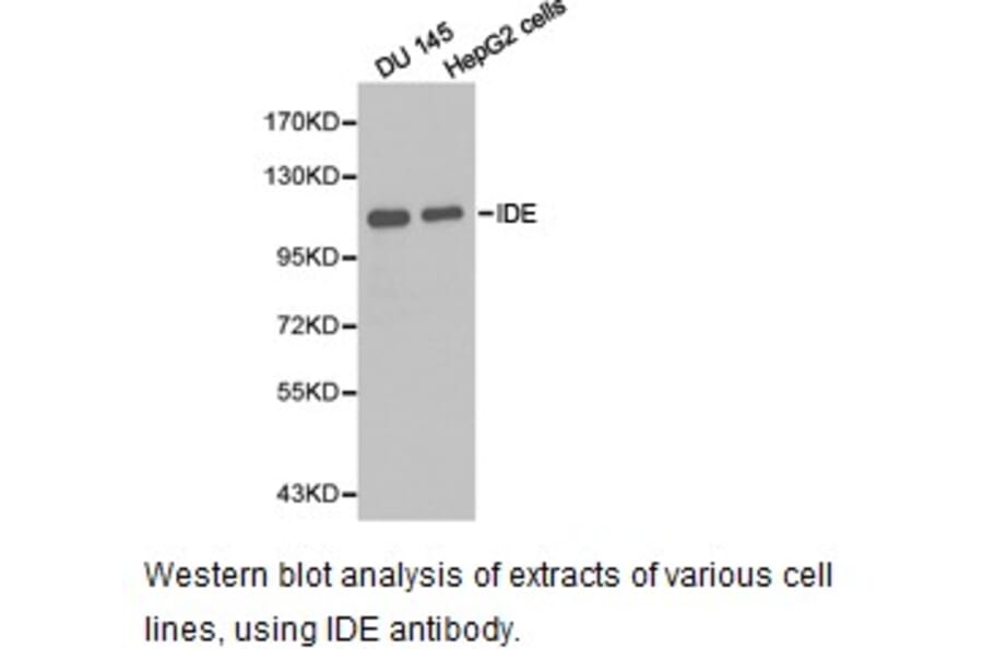 Anti-IDE Antibody from Bioworld Technology (BS6849) - Antibodies.com