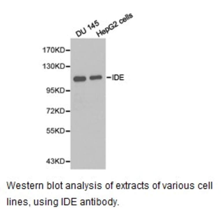 Anti-IDE Antibody from Bioworld Technology (BS6849) - Antibodies.com