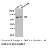 Anti-IDE Antibody from Bioworld Technology (BS6849) - Antibodies.com