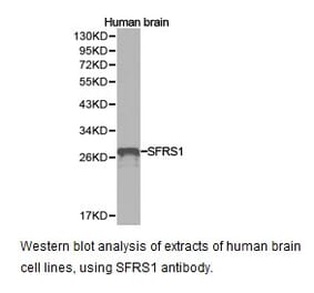 Anti-SFRS1 Antibody from Bioworld Technology (BS6851) - Antibodies.com