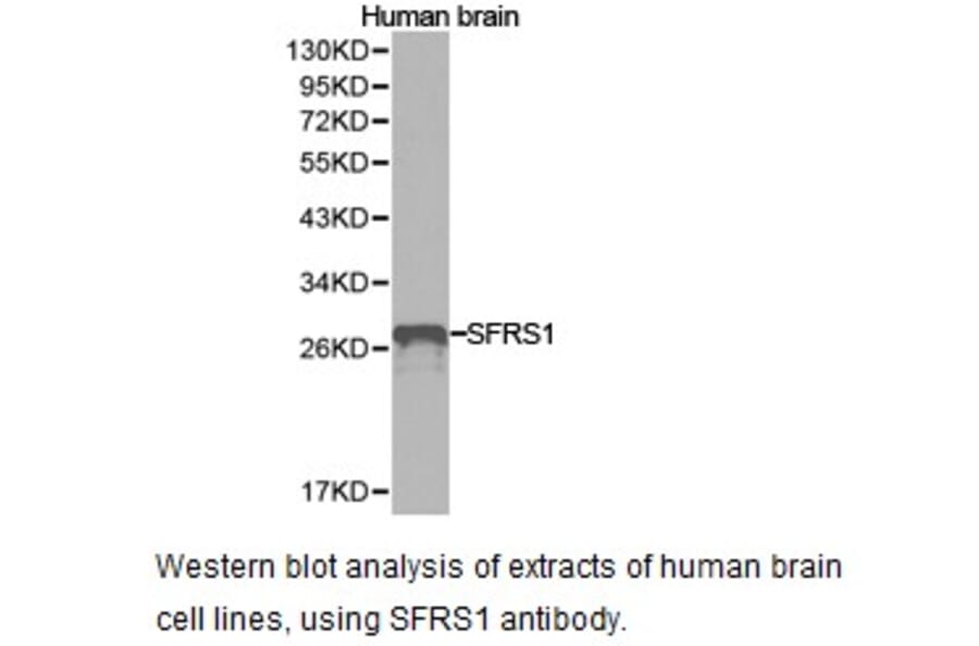 Anti-SFRS1 Antibody from Bioworld Technology (BS6851) - Antibodies.com