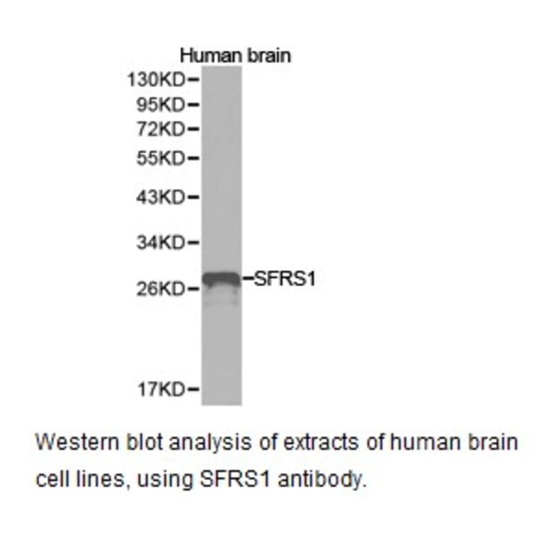 Anti-SFRS1 Antibody from Bioworld Technology (BS6851) - Antibodies.com