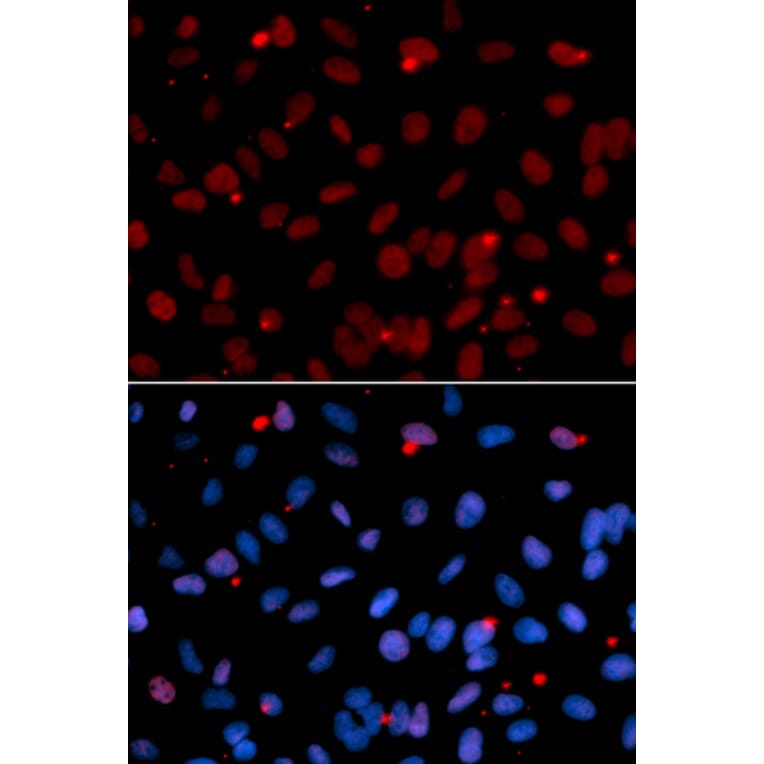 Anti-SFRS1 Antibody from Bioworld Technology (BS6851) - Antibodies.com