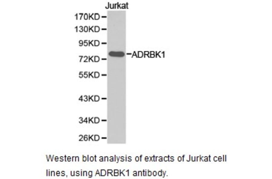 Anti-GRK 2 / ADRBK1 Antibody from Bioworld Technology (BS6853) - Antibodies.com
