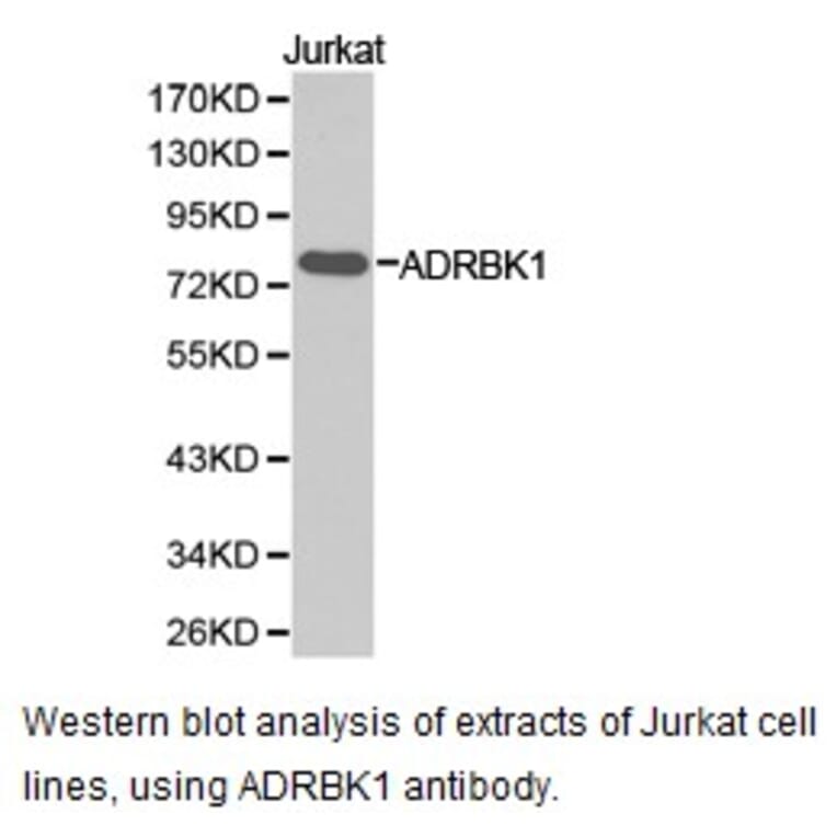 Anti-GRK 2 / ADRBK1 Antibody from Bioworld Technology (BS6853) - Antibodies.com