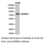 Anti-GRK 2 / ADRBK1 Antibody from Bioworld Technology (BS6853) - Antibodies.com