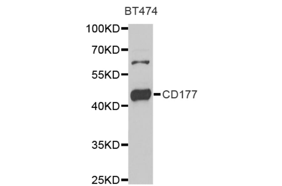 Anti-CD177 Antibody from Bioworld Technology (BS6857) - Antibodies.com