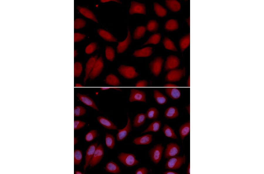 Anti-CD3-ε Antibody from Bioworld Technology (BS6859) - Antibodies.com