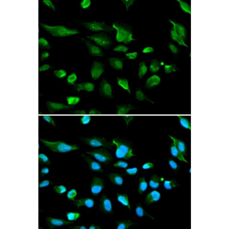 Anti-AIRE Antibody from Bioworld Technology (BS6860) - Antibodies.com