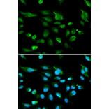 Anti-AIRE Antibody from Bioworld Technology (BS6860) - Antibodies.com