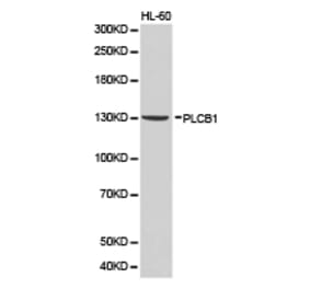 Anti-PLCB1 Antibody from Bioworld Technology (BS6868) - Antibodies.com
