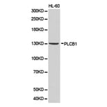 Anti-PLCB1 Antibody from Bioworld Technology (BS6868) - Antibodies.com