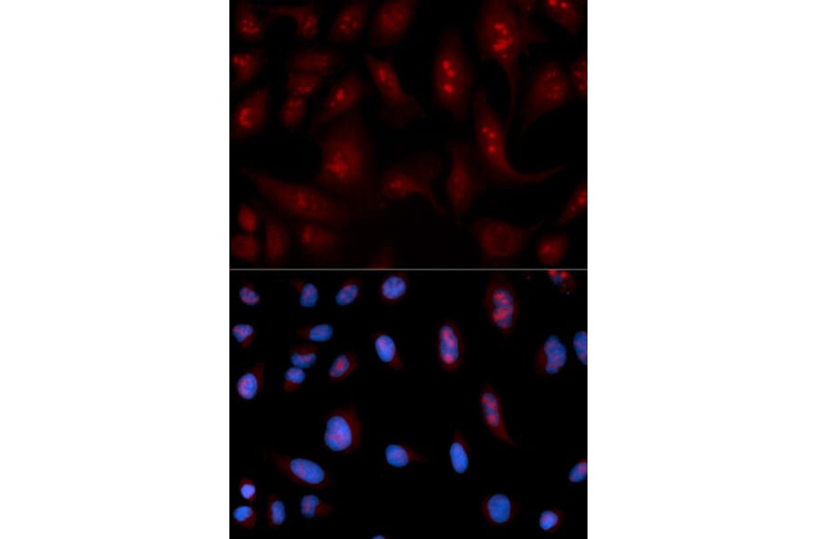Anti-PLCB1 Antibody from Bioworld Technology (BS6868) - Antibodies.com