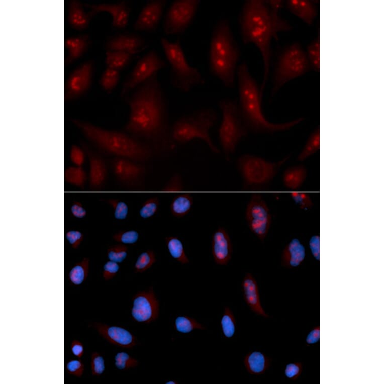 Anti-PLCB1 Antibody from Bioworld Technology (BS6868) - Antibodies.com