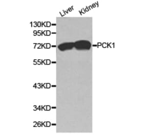 Anti-PCK1 Antibody from Bioworld Technology (BS6870) - Antibodies.com