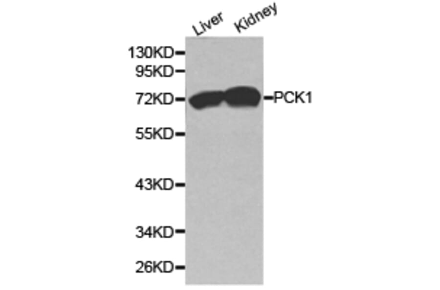 Anti-PCK1 Antibody from Bioworld Technology (BS6870) - Antibodies.com