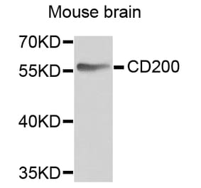 Anti-CD200 Antibody from Bioworld Technology (BS6871) - Antibodies.com