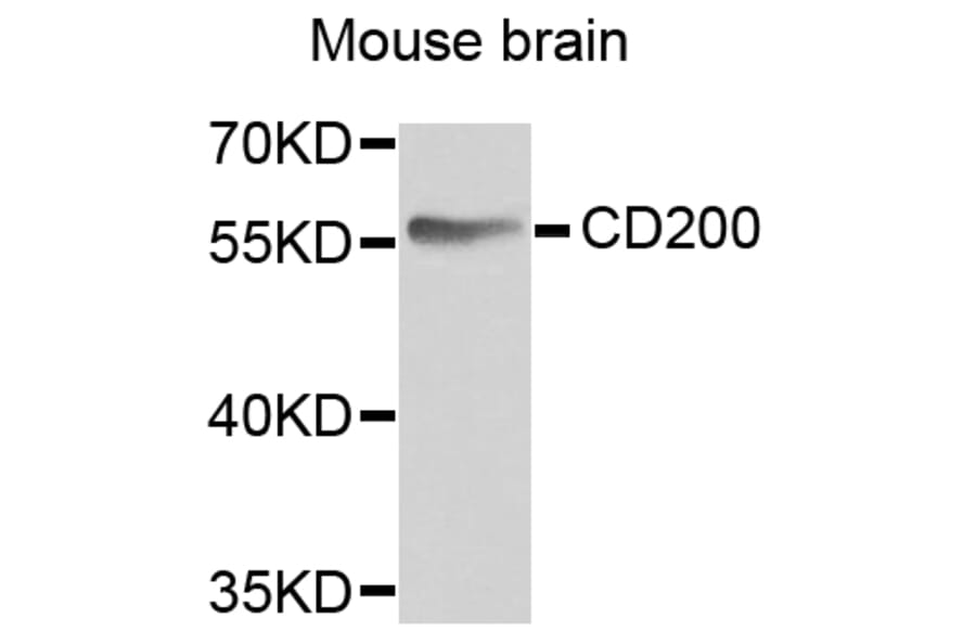 Anti-CD200 Antibody from Bioworld Technology (BS6871) - Antibodies.com