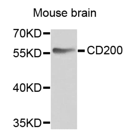 Anti-CD200 Antibody from Bioworld Technology (BS6871) - Antibodies.com