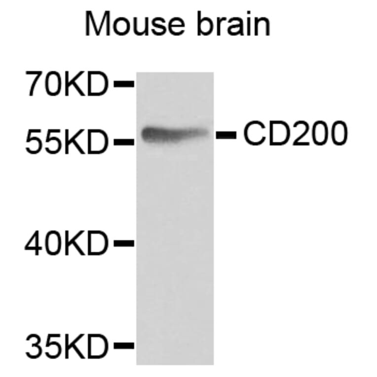 Anti-CD200 Antibody from Bioworld Technology (BS6871) - Antibodies.com