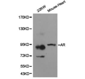 Anti-AR Antibody from Bioworld Technology (BS6872) - Antibodies.com