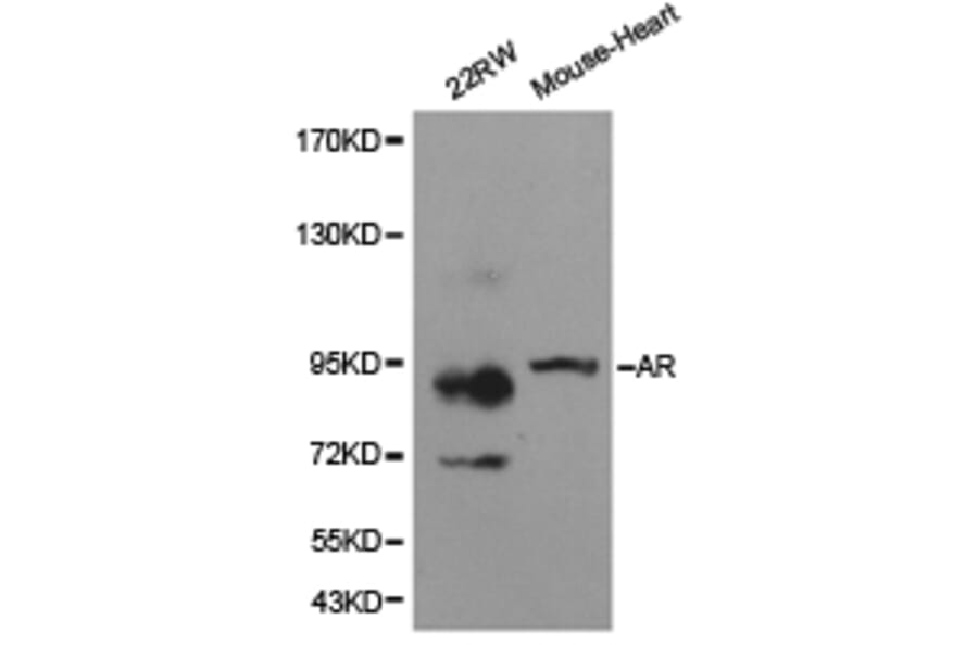 Anti-AR Antibody from Bioworld Technology (BS6872) - Antibodies.com