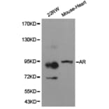 Anti-AR Antibody from Bioworld Technology (BS6872) - Antibodies.com