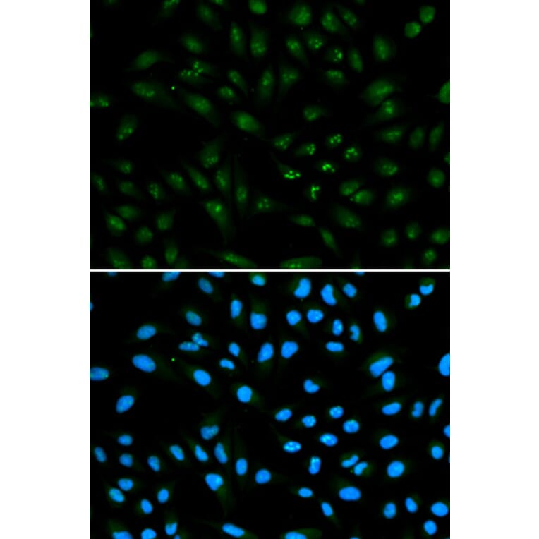 Anti-AR Antibody from Bioworld Technology (BS6872) - Antibodies.com
