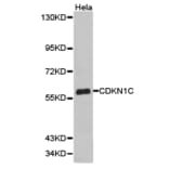 Anti-p57/CDKN1C Antibody from Bioworld Technology (BS6876) - Antibodies.com