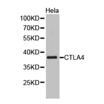 Anti-CTLA4 Antibody from Bioworld Technology (BS6878) - Antibodies.com