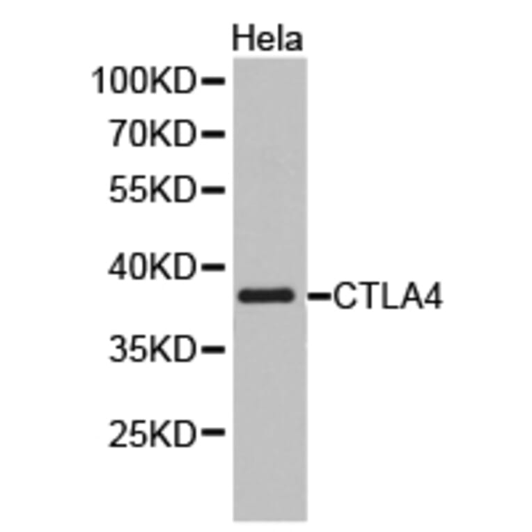 Anti-CTLA4 Antibody from Bioworld Technology (BS6878) - Antibodies.com