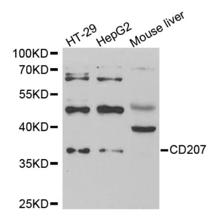 Anti-CD207 Antibody from Bioworld Technology (BS6881) - Antibodies.com