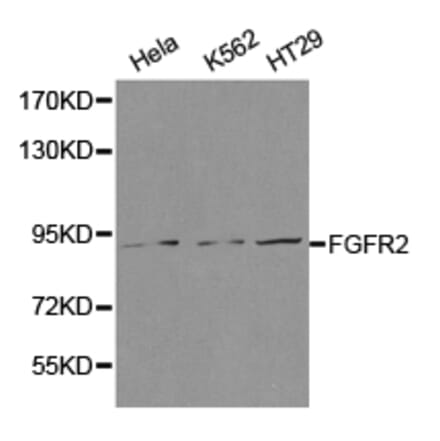 Anti-FGFR2 Antibody from Bioworld Technology (BS6883) - Antibodies.com