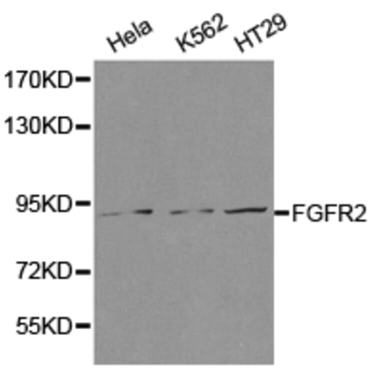 Anti-FGFR2 Antibody from Bioworld Technology (BS6883) - Antibodies.com