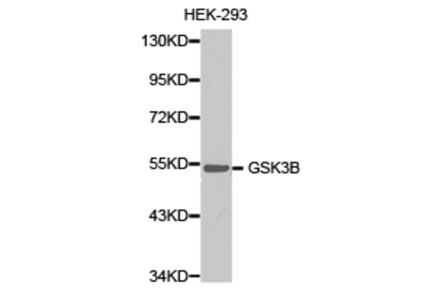 Anti-GSK3β Antibody from Bioworld Technology (BS6886) - Antibodies.com