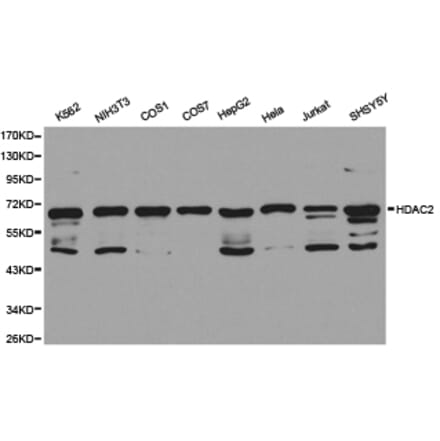 Anti-HDAC2 Antibody from Bioworld Technology (BS6887) - Antibodies.com