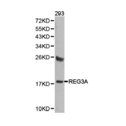 Anti-REG3A Antibody from Bioworld Technology (BS6896) - Antibodies.com