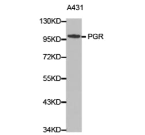 Anti-PR Antibody from Bioworld Technology (BS6898) - Antibodies.com