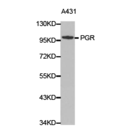 Anti-PR Antibody from Bioworld Technology (BS6898) - Antibodies.com