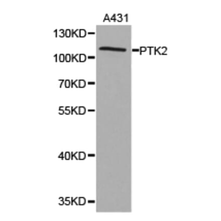 Anti-FAK Antibody from Bioworld Technology (BS6899) - Antibodies.com