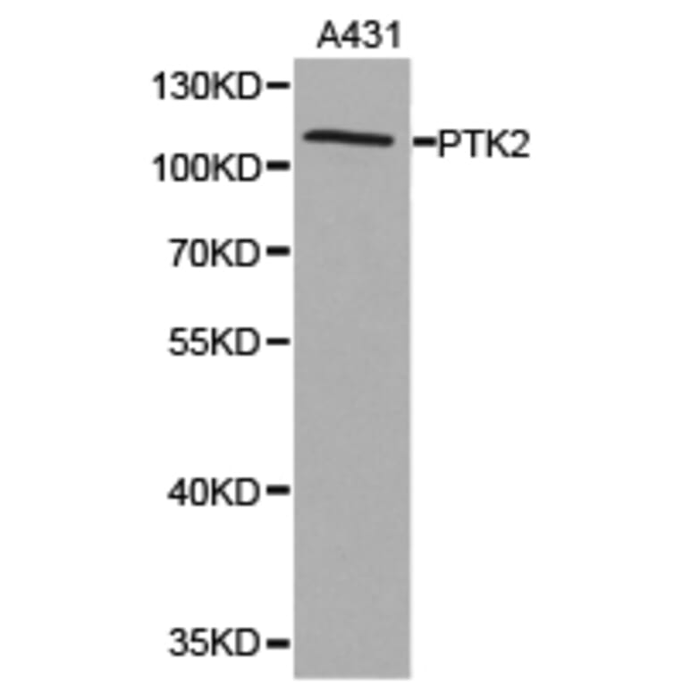 Anti-FAK Antibody from Bioworld Technology (BS6899) - Antibodies.com