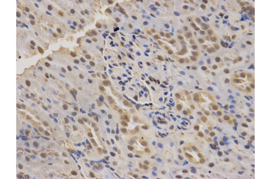 Anti-SMARCA4 Antibody from Bioworld Technology (BS6902) - Antibodies.com