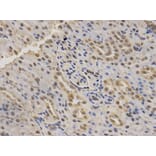 Anti-SMARCA4 Antibody from Bioworld Technology (BS6902) - Antibodies.com