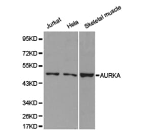 Anti-AURKA Antibody from Bioworld Technology (BS6903) - Antibodies.com