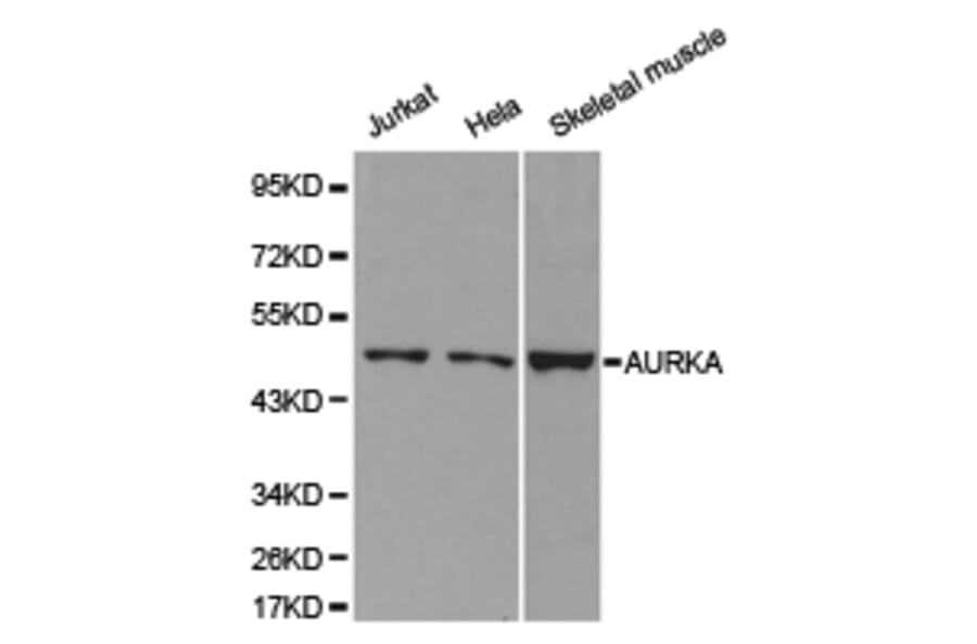 Anti-AURKA Antibody from Bioworld Technology (BS6903) - Antibodies.com