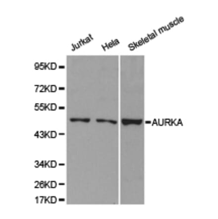 Anti-AURKA Antibody from Bioworld Technology (BS6903) - Antibodies.com