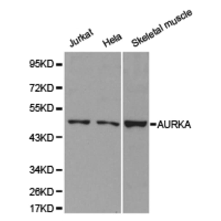 Anti-AURKA Antibody from Bioworld Technology (BS6903) - Antibodies.com